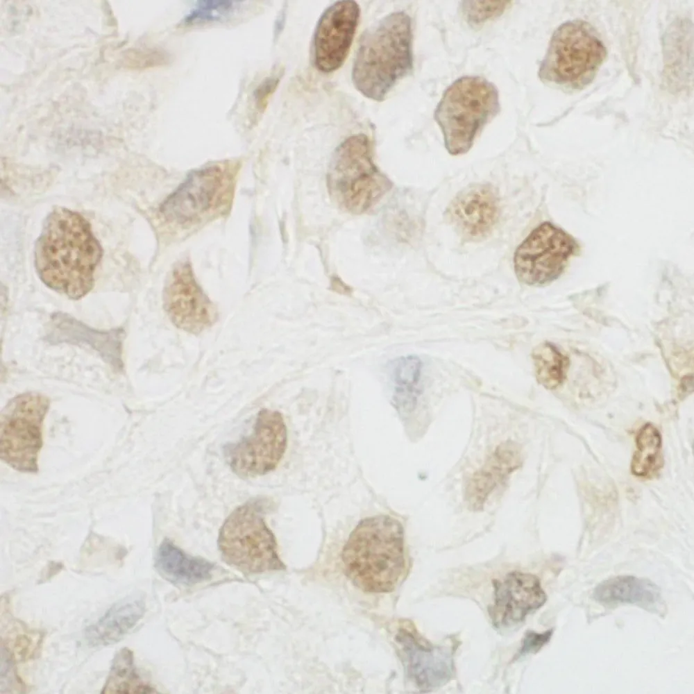 Rabbit anti-HCA66 IHC Antibody, Affinity Purified