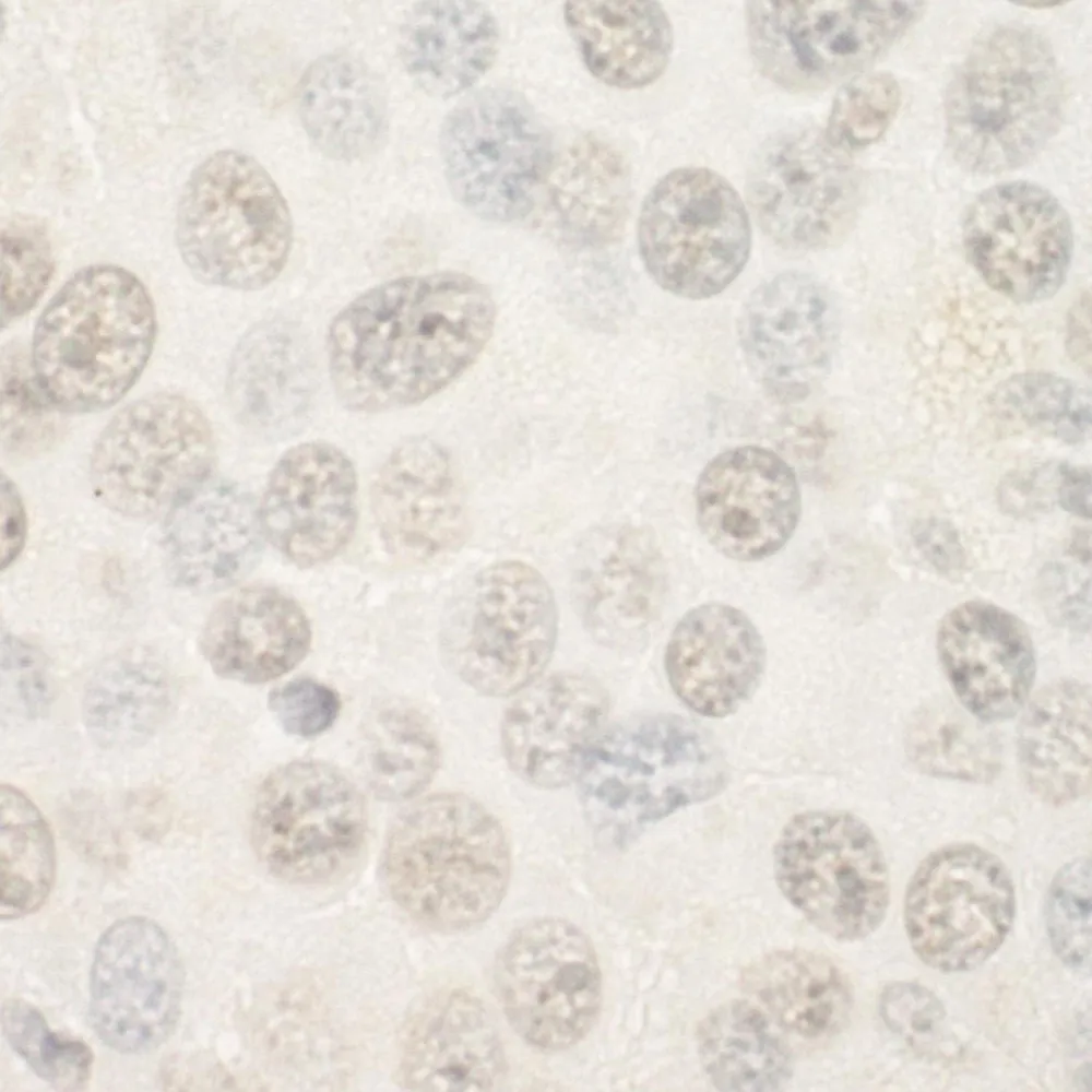 Rabbit anti-FOXP1 IHC Antibody, Affinity Purified