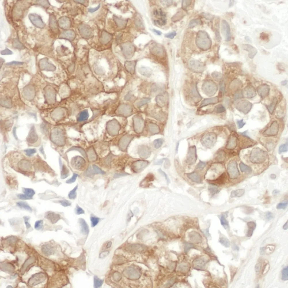 Rabbit anti-Cortactin IHC Antibody, Affinity Purified