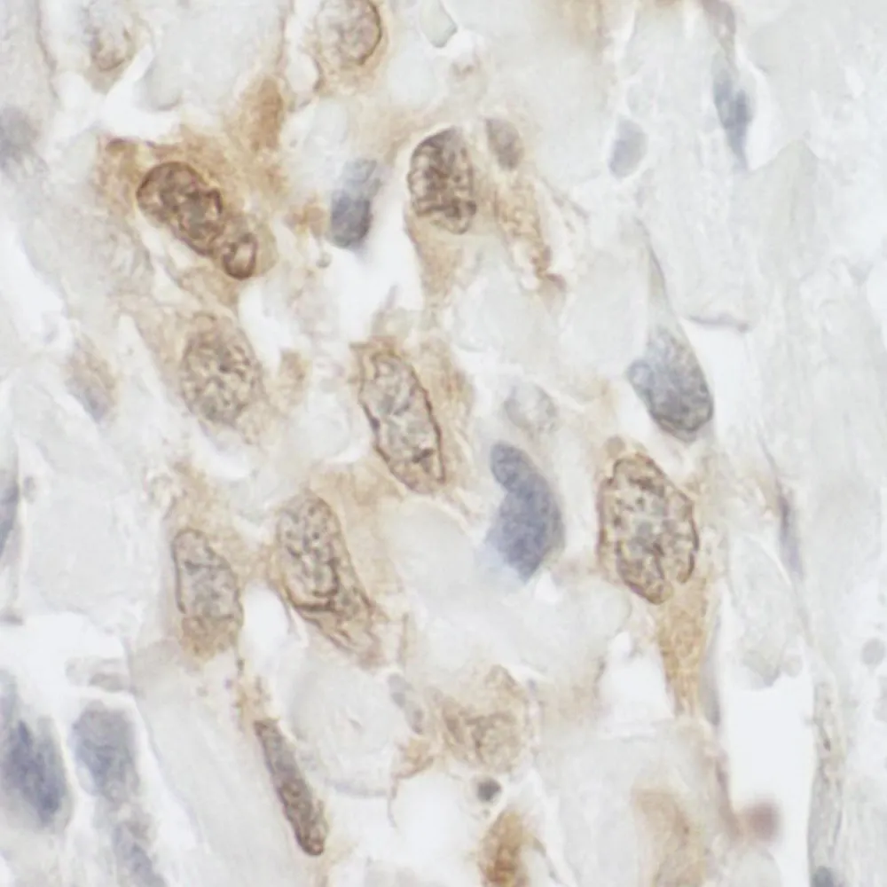 Rabbit anti-LPP IHC Antibody, Affinity Purified