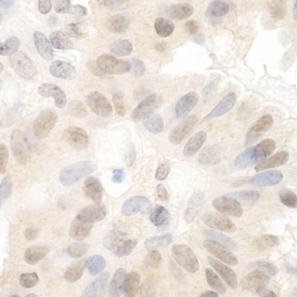 Rabbit anti-SAP130 IHC Antibody, Affinity Purified