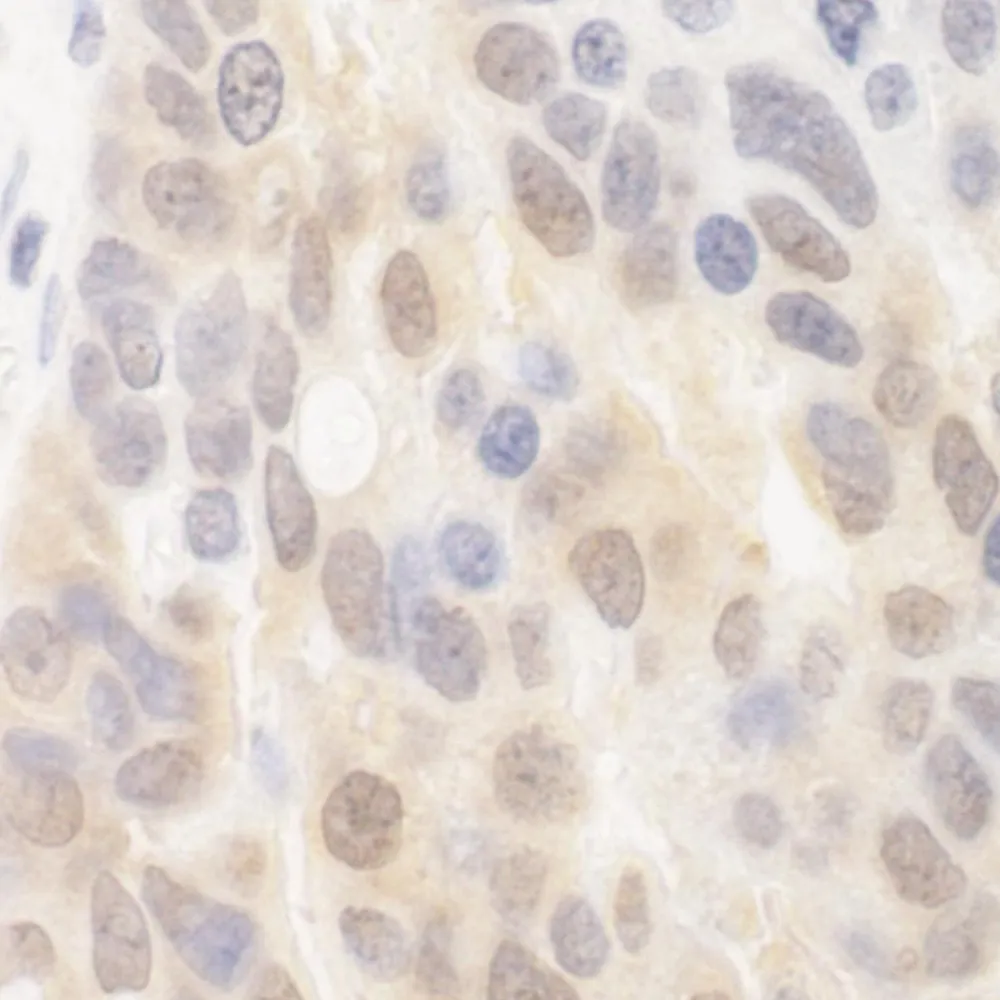 Rabbit anti-SPATA2 IHC Antibody, Affinity Purified