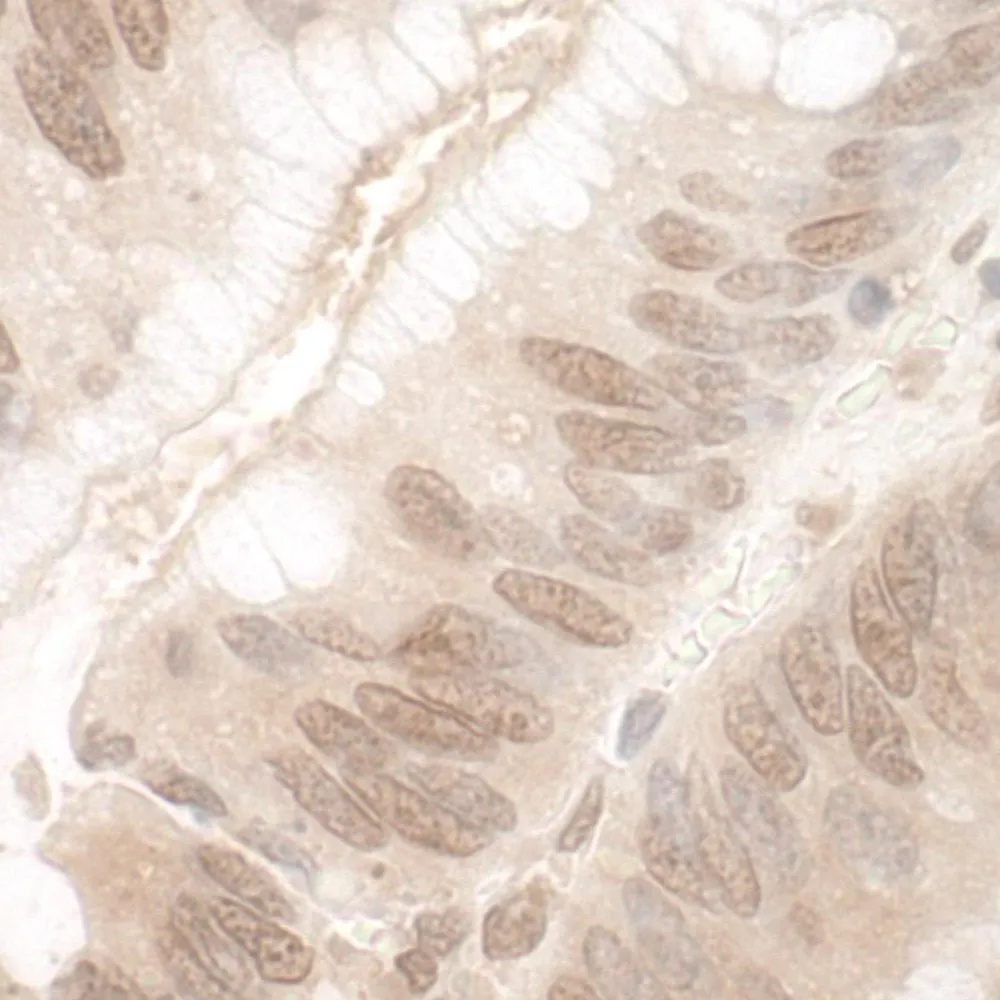 Rabbit anti-EYA3 IHC Antibody, Affinity Purified