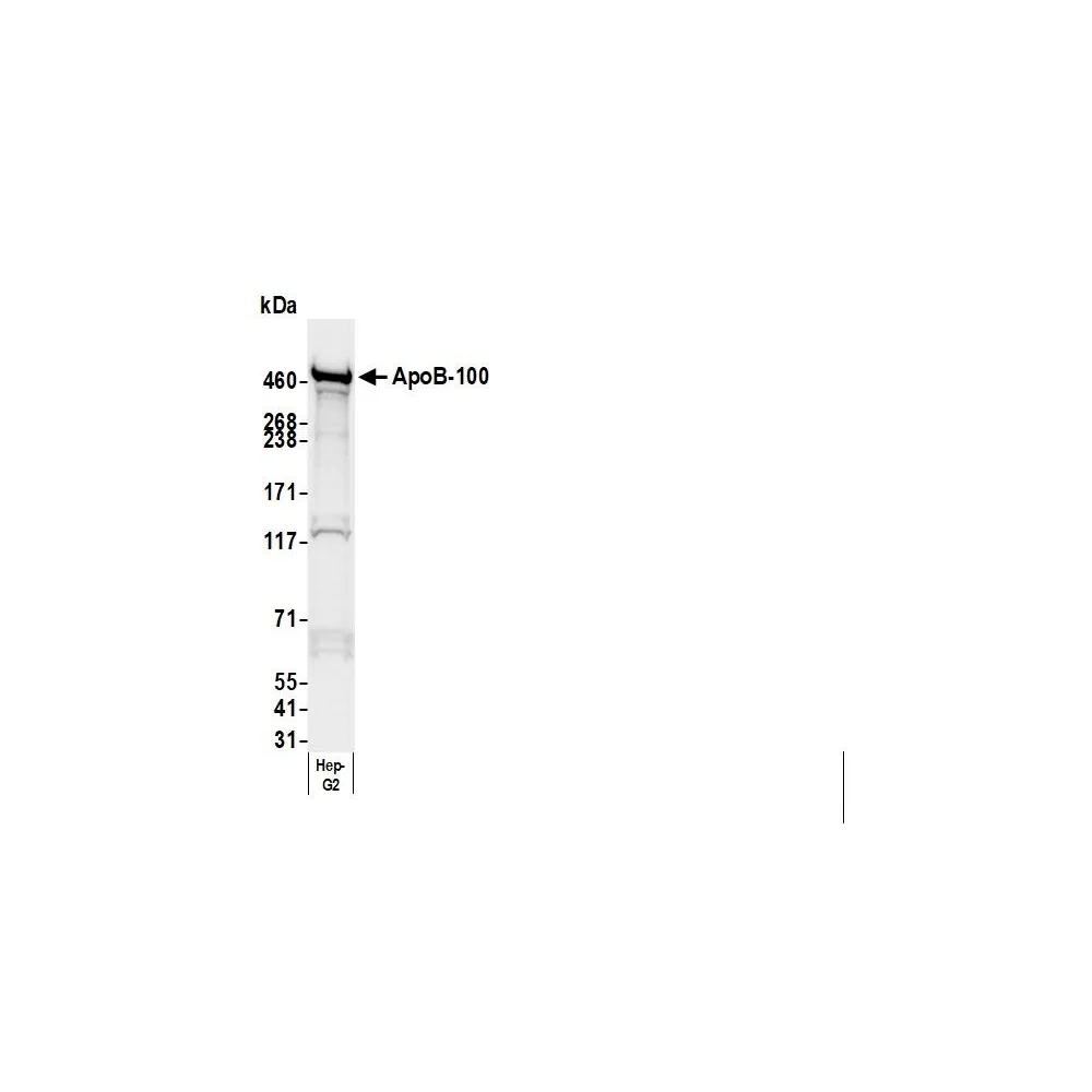 Goat anti-Human Apo B-100 Antibody Agarose Immobilized