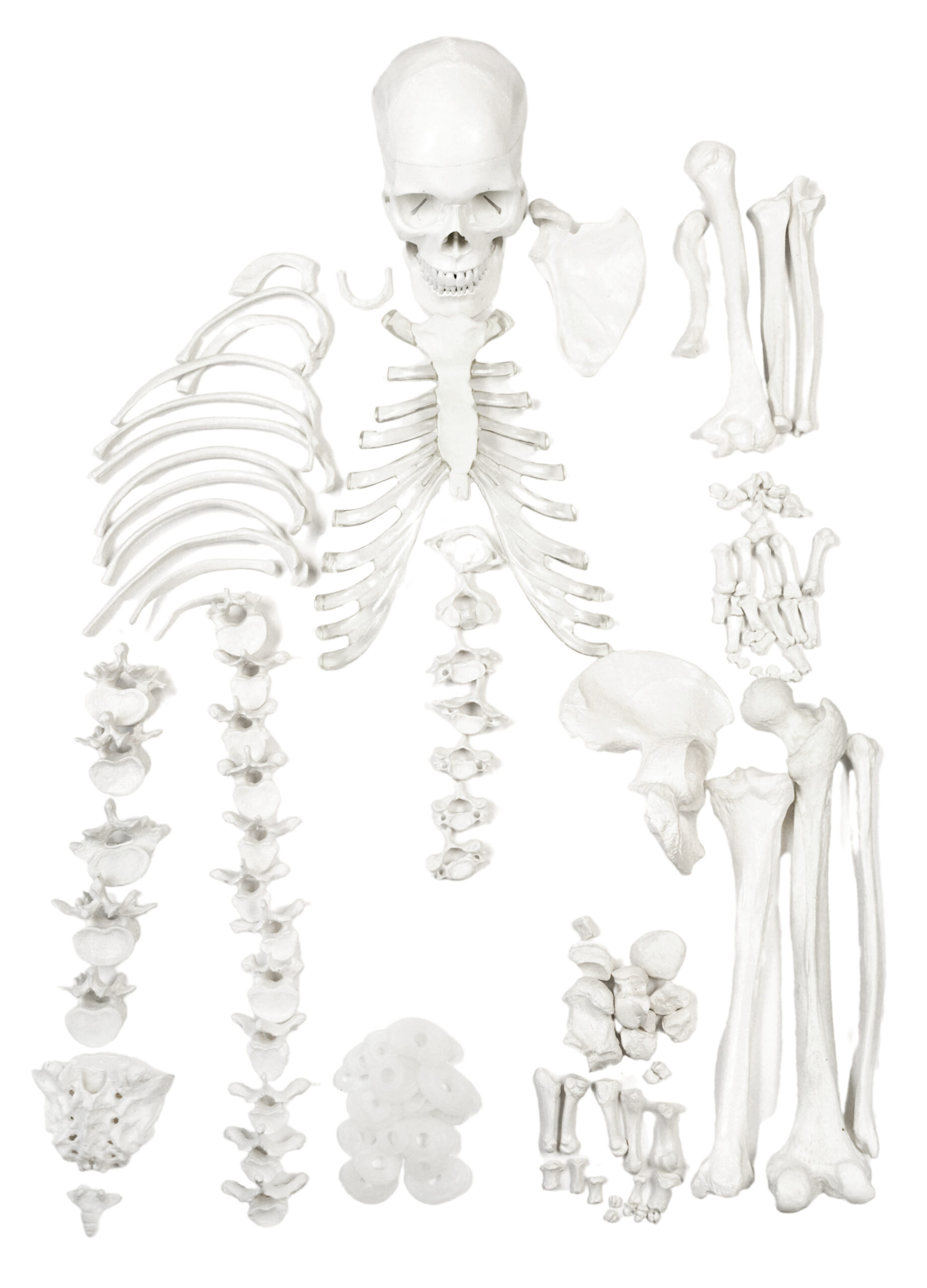 Disarticulated Human Skeleton - HALF - Medical Quality, Life Sized (62" Model Height) - 23 Intervertebral Discs, 3 Part Skull with Moveable Jaw